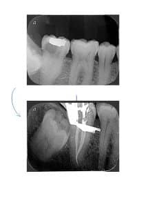 endodonciamiroscopio