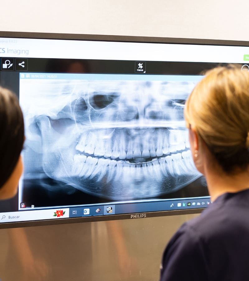 clinica dental zaragoza estetica dental