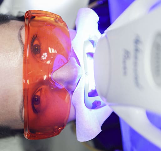 blanqueamiento dental
