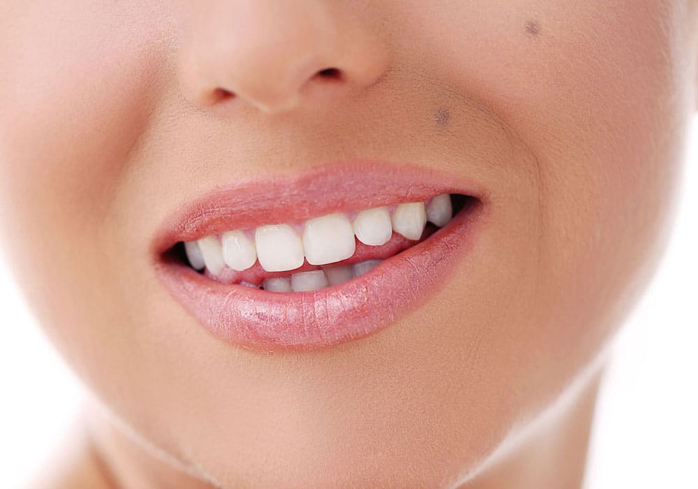 estetica dental zaragoza